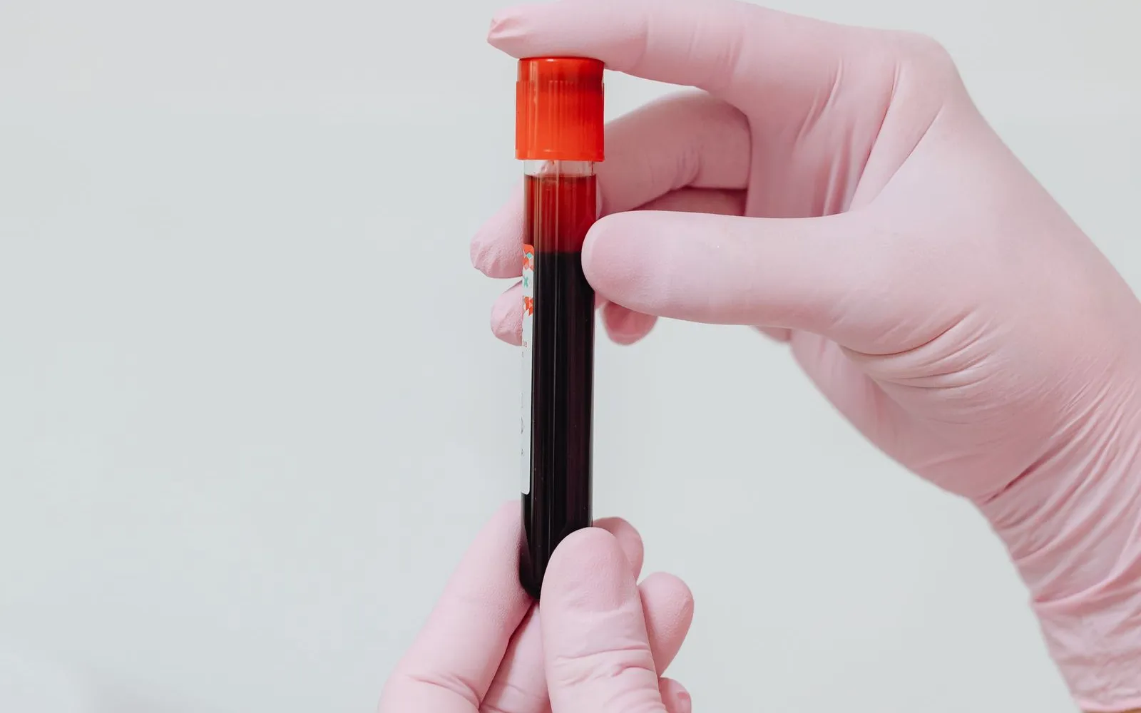 Two gloved hands holding a capped tube of blood against a plain pale background