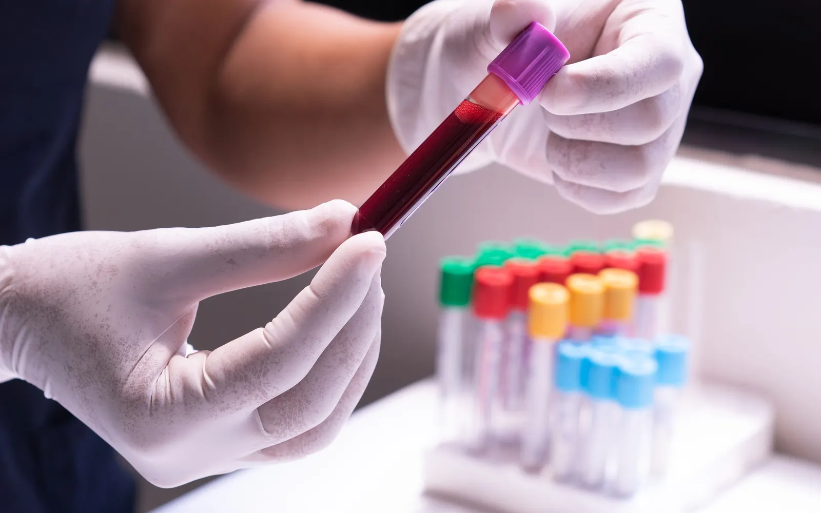 Gloved hands holding a blood sample tube beside a rack of capped sample tubes.